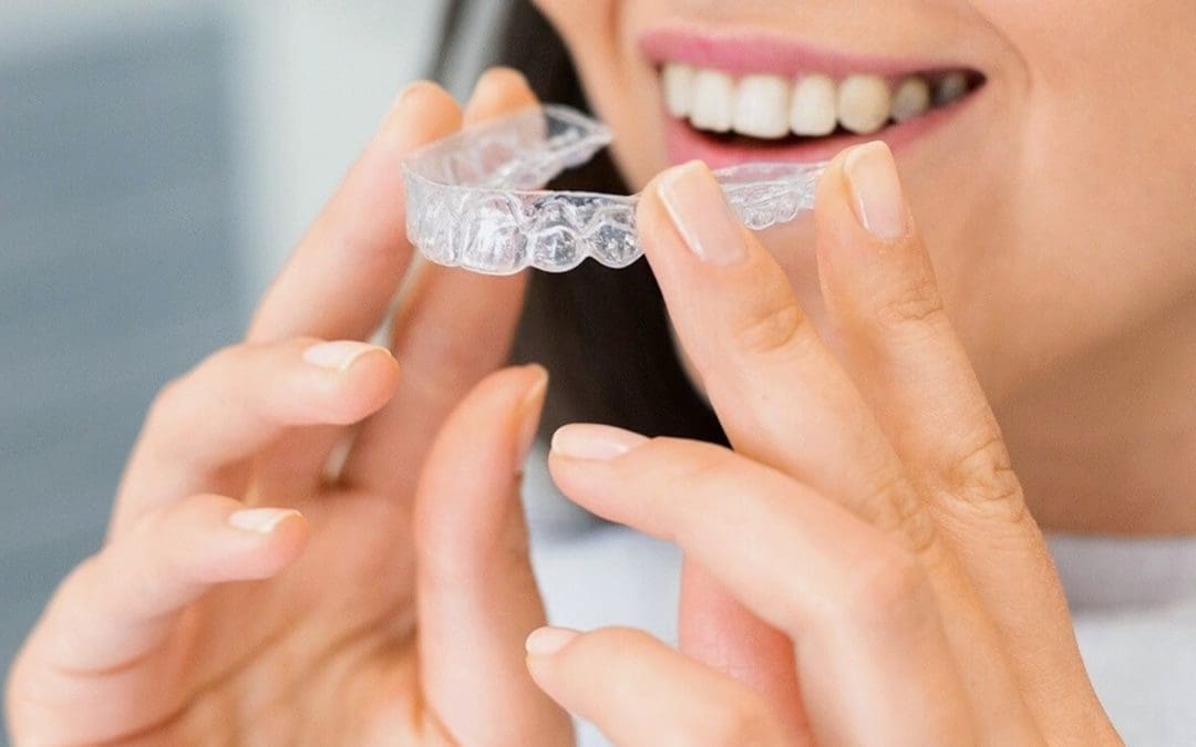Discover the Best Invisalign Dentist in Kellyville: Your Path to a Confident Smile